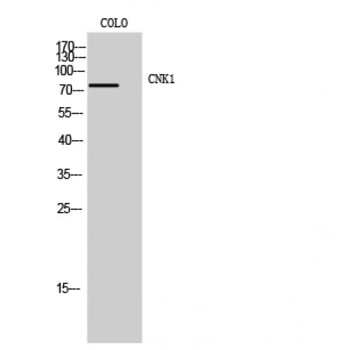 Polyclonal Rabbit anti-Human CNKSR1 Antibody (460-540 aa, Internal, IHC, IF, WB)