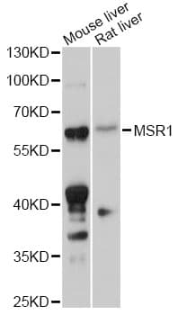 Polyclonal Rabbit anti-Human MSR1 / CD204 Antibody (IF, WB)