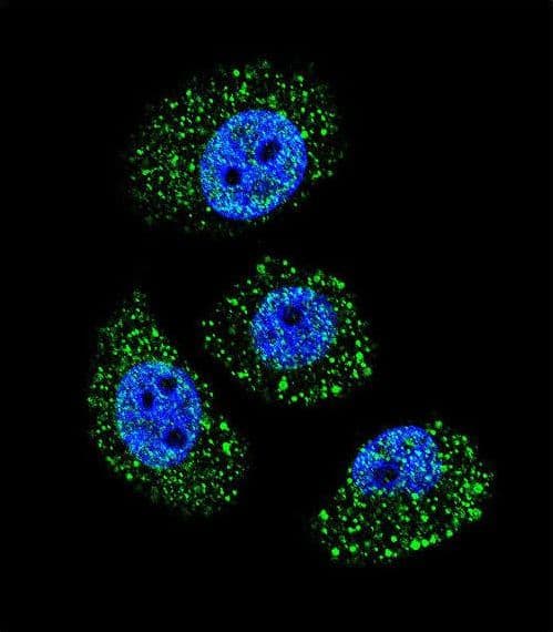 MYBPHL Antibody (aa80-108)