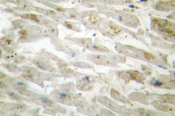 Polyclonal Rabbit anti-Human DLX3 Antibody (Asp107, IHC, WB)