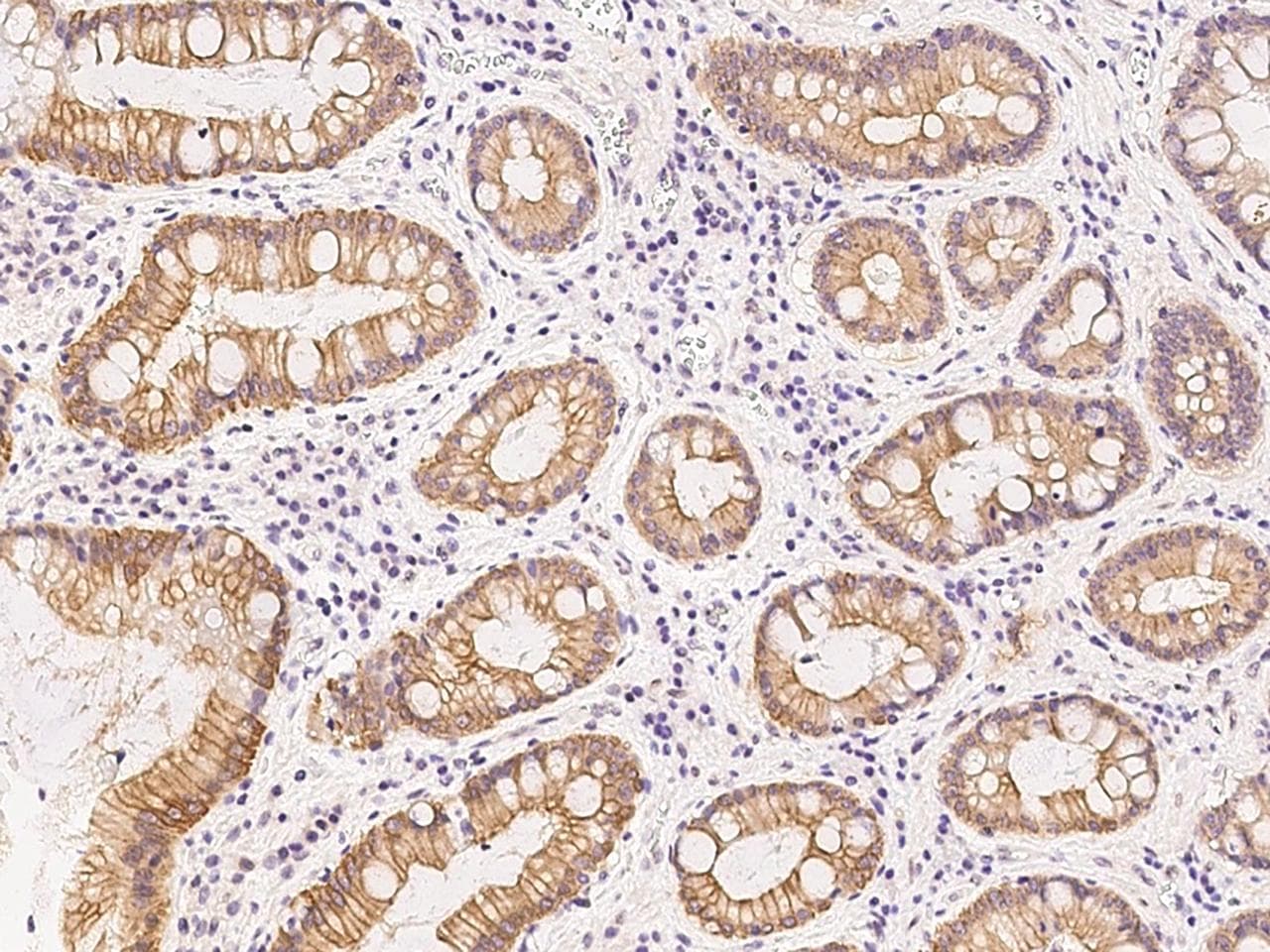 Polyclonal Rabbit anti-Human NRM Antibody (Preservative Free, IHC, WB)