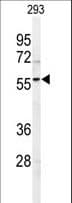 Polyclonal Rabbit anti-Human SPHK / SPHK1 Antibody (aa313-343, IHC, WB)