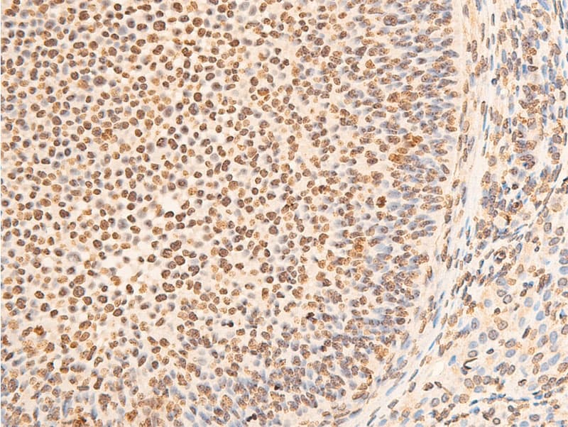 Polyclonal Rabbit anti-Human EIF2S1 Antibody (phospho-Ser51, IHC, IF, WB)