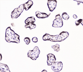 UBE2I / UBC9 Antibody
