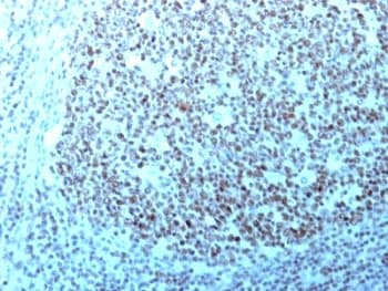 NCL / Nucleolin Antibody (aa364-365, clone 364-5 + NCL/902, Ready-to-Use)