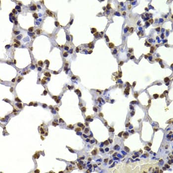 CBX5 / HP1 Alpha Antibody