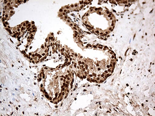 CDK15 / ALS2CR7 Antibody (aa293-378, clone OTI5C4)