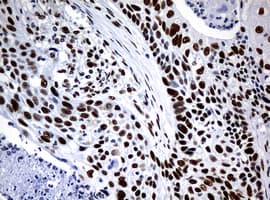 NBN / Nibrin Antibody (clone OTI3A9)