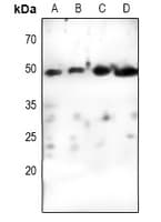 CCNE1 / Cyclin E1 Antibody