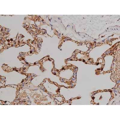 Polyclonal Rabbit anti-Human ZAP70 Antibody (phospho-Tyr319, IHC, IF, WB)