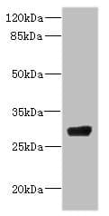 NAR / CPSF4 Antibody