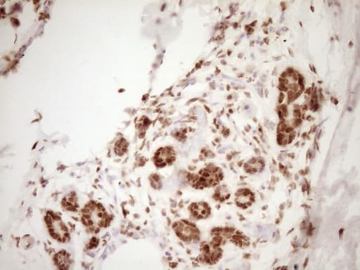 NUDT21 Antibody (aa2-227, clone OTI5B3)