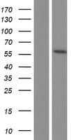 TRMT2B Protein (Over-Expression Lysate Myc-DDK (Flag))
