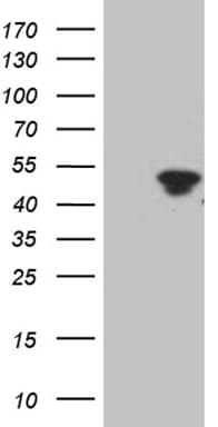 TFEC Antibody (clone OTI2A9)