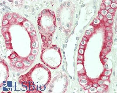 IHC-plus™ ARRDC3 Antibody (C-Terminus)