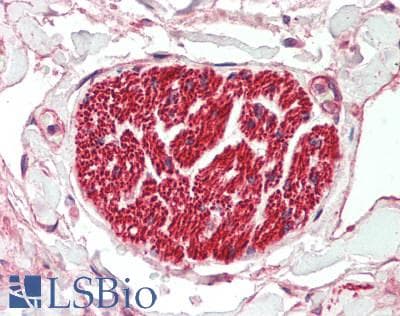 IHC-plus™ PIEZO2 / FAM38B Antibody