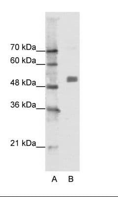 CHRNA9 Antibody (N-Terminus)