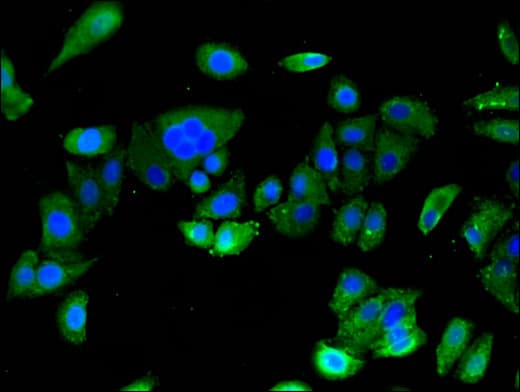 Polyclonal Rabbit anti-Human ASTN2 Antibody (IHC, IF, WB)