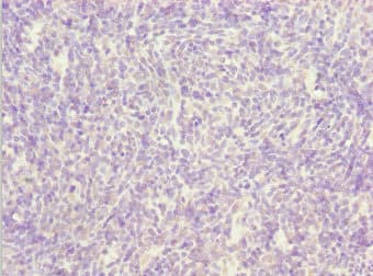 SIK3 / QSK Antibody