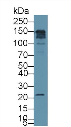 CD164 Antibody (aa24-162)