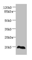 EEF1E1 / AIMP3 Antibody (aa2-174)