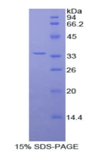 Rat Fibulin-3 / EFEMP1 Protein (Recombinant His)
