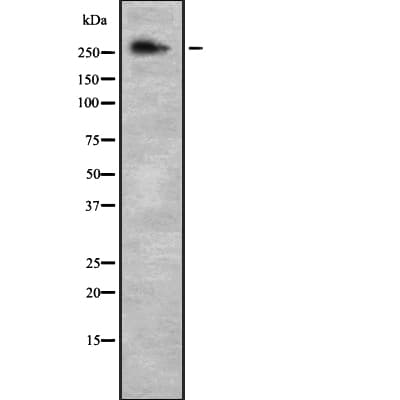NCOR2 / SMRT Antibody