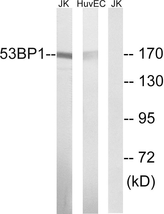TP53BP1 / 53BP1 Antibody (Ab-29)