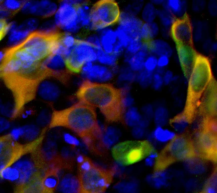 Streptococcus pyogenes CRISPR-associated endonuclease Cas9/Csn1 Antibody (C-term, clone 6F7)