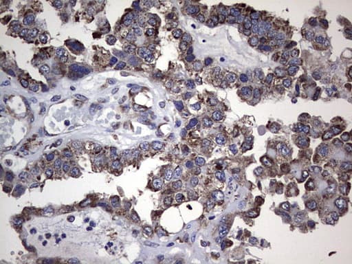 MTDH / Metadherin Antibody (aa70-582, clone OTI1B6)
