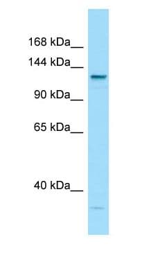 Polyclonal Rabbit anti-Human LAMC3 / Laminin Gamma 3 Antibody (aa1381-1430, WB)