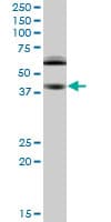 RING1 Antibody (clone 2B3)