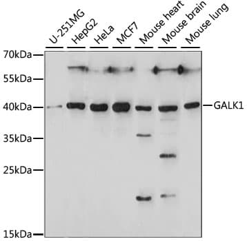 GALK1 / GK1 Antibody