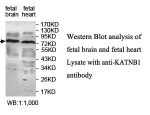 KATNB1 Antibody (aa429-578)