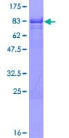 Human IKZF1 / IKAROS Protein (Recombinant GST)