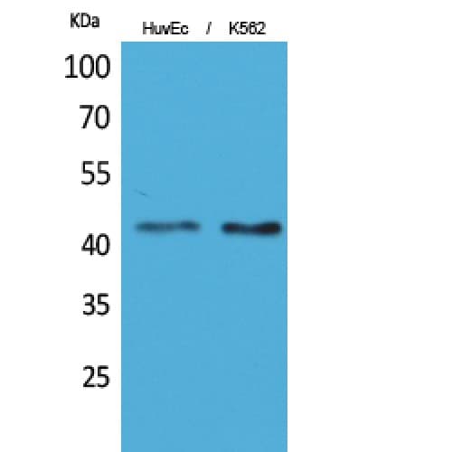 Layilin / LAYN Antibody (71-120 aa, Internal)