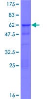 Human ZNF428 Protein (Recombinant GST)