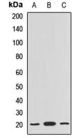Polyclonal Rabbit anti-Human PLDN / Pallidin Antibody (WB)