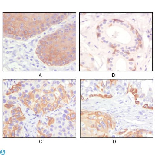 KRT5 / CK5 / Cytokeratin 5 Antibody
