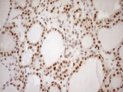 MGMT Antibody (clone OTI5A7)