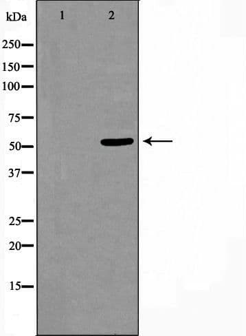 CELF1 / CUGBP1 Antibody