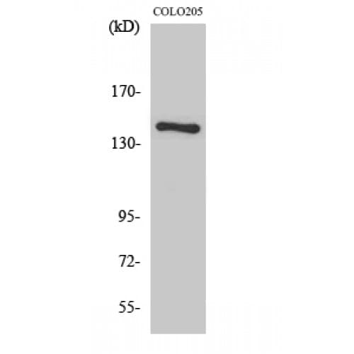 Polyclonal Rabbit anti-Human COL2A1 / Collagen II Alpha 1 Antibody (70-150 aa, N-terminal, IHC, IF, WB)
