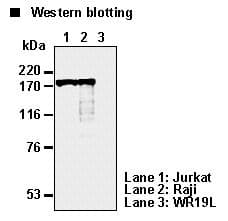 Monoclonal Mouse anti-Human TOP2A / Topoisomerase II Alpha Antibody (clone 1C5, IHC, WB)