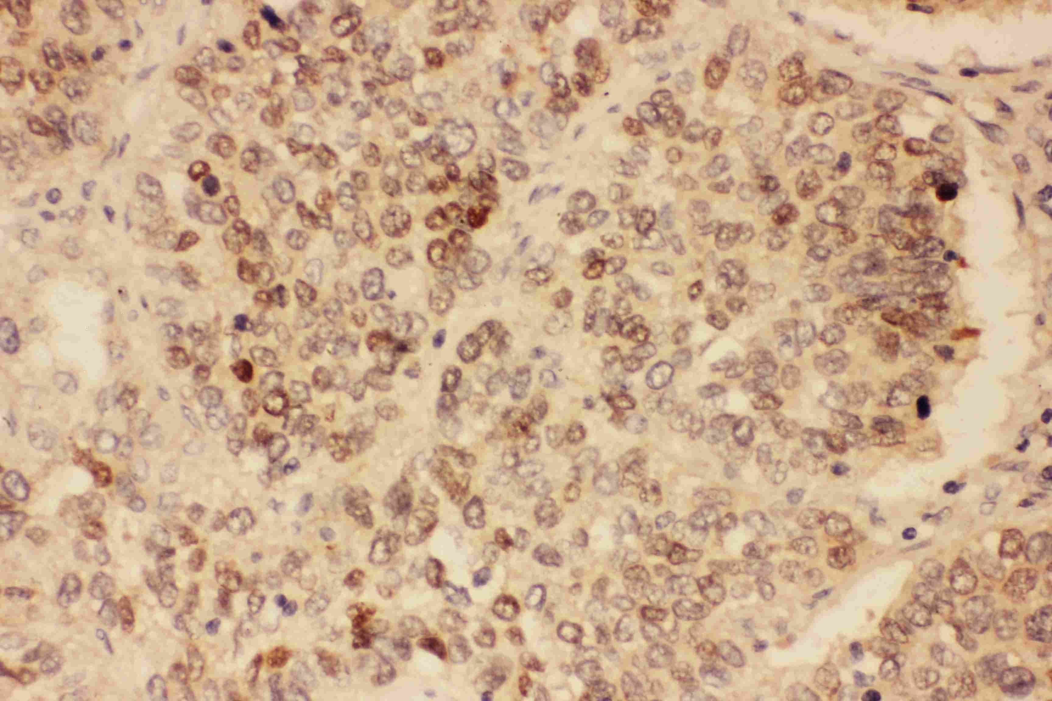 SOX2 Antibody (aa171-183)
