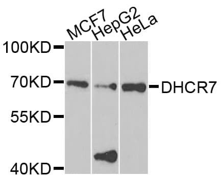 Polyclonal Rabbit anti-Human DHCR7 Antibody (IHC, IF, WB)