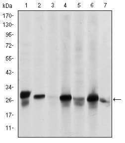 HSPB2 / HSP27 Antibody (clone 5D7)