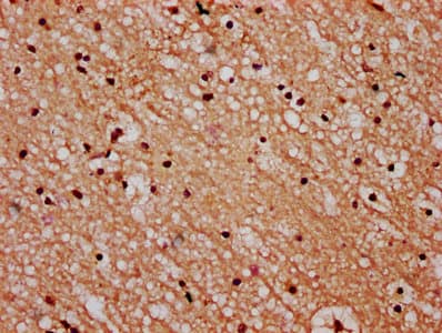 STH Antibody