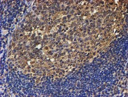 PSMB9 Antibody (aa21-219, clone OTI2G6)