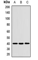 TMOD3 / Tropomodulin 3 Antibody