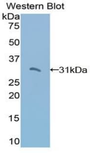 TRADD Antibody (aa61-297, FITC)
